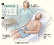 冠心病需要做哪些檢查？